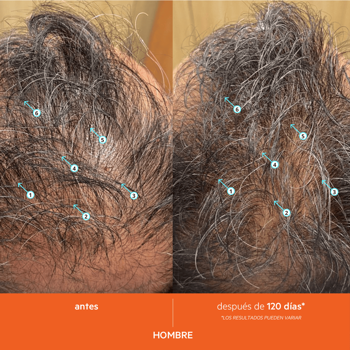REVITA SHAMPOO - Imagen 14