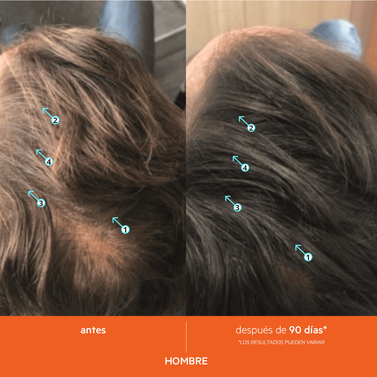 REVITA SHAMPOO - Imagen 13
