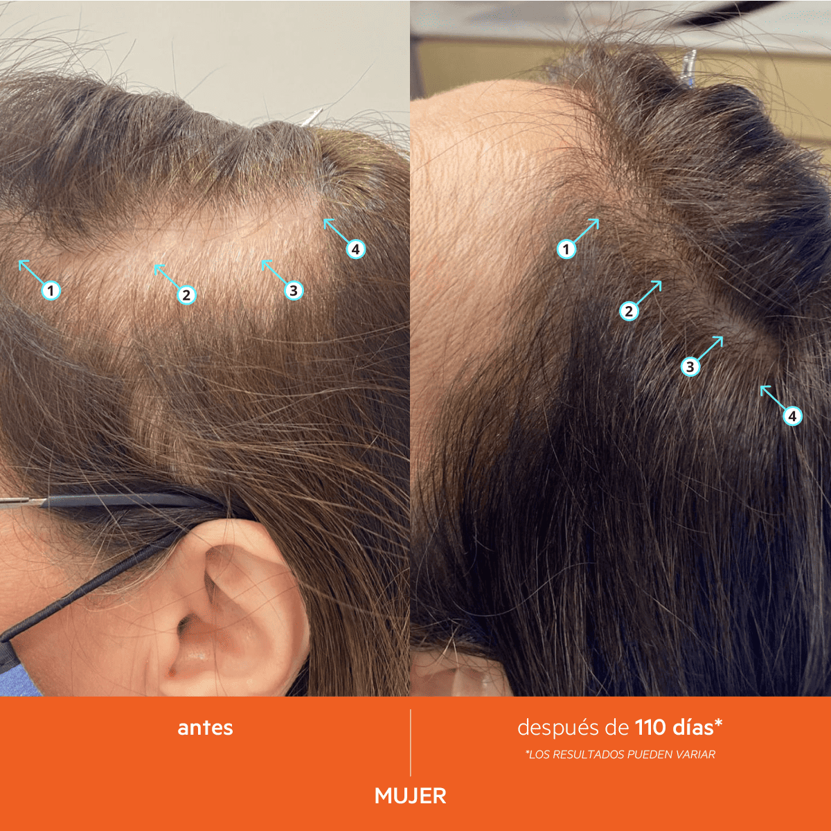 REVITA SHAMPOO - Imagen 12