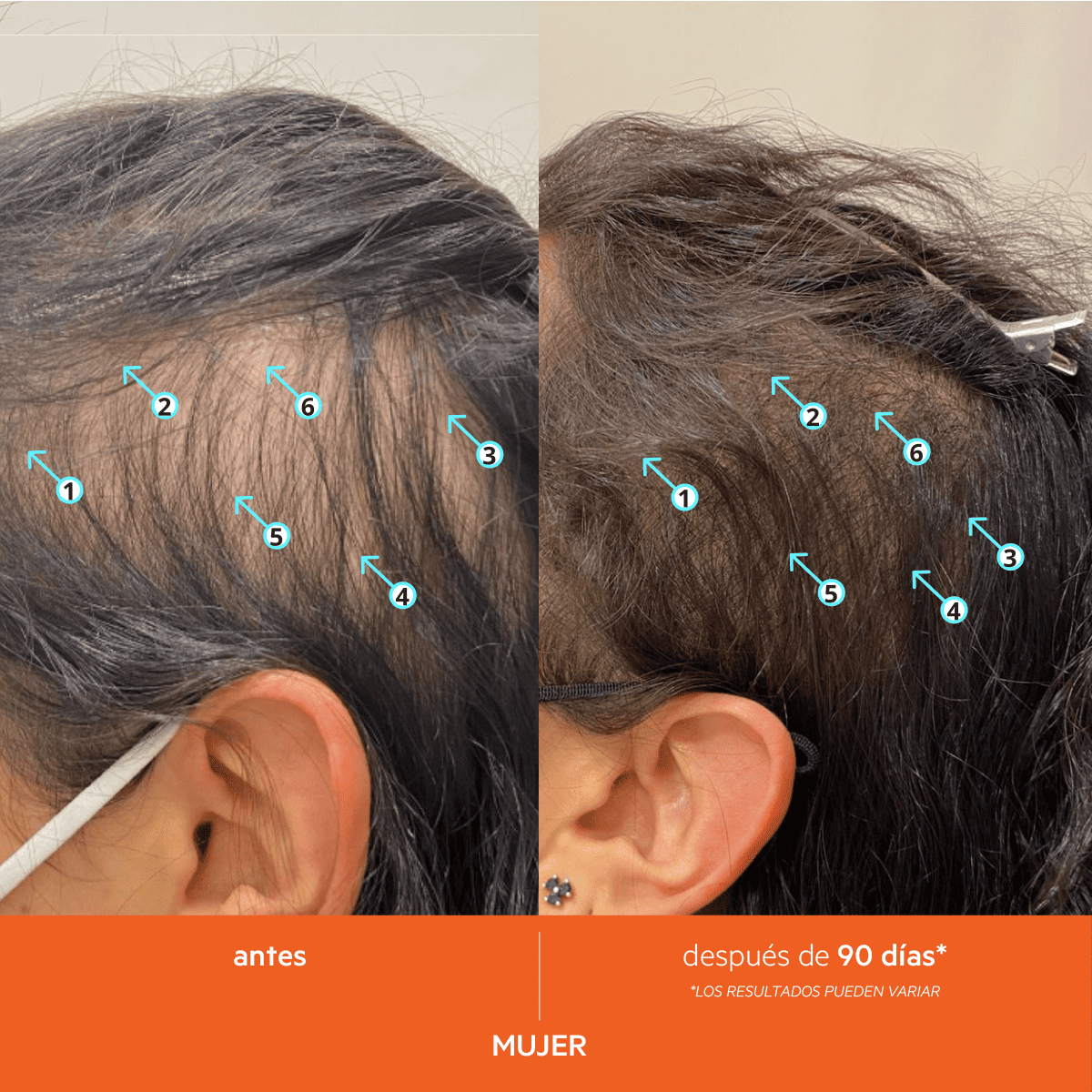 REVITA SHAMPOO - Imagen 11